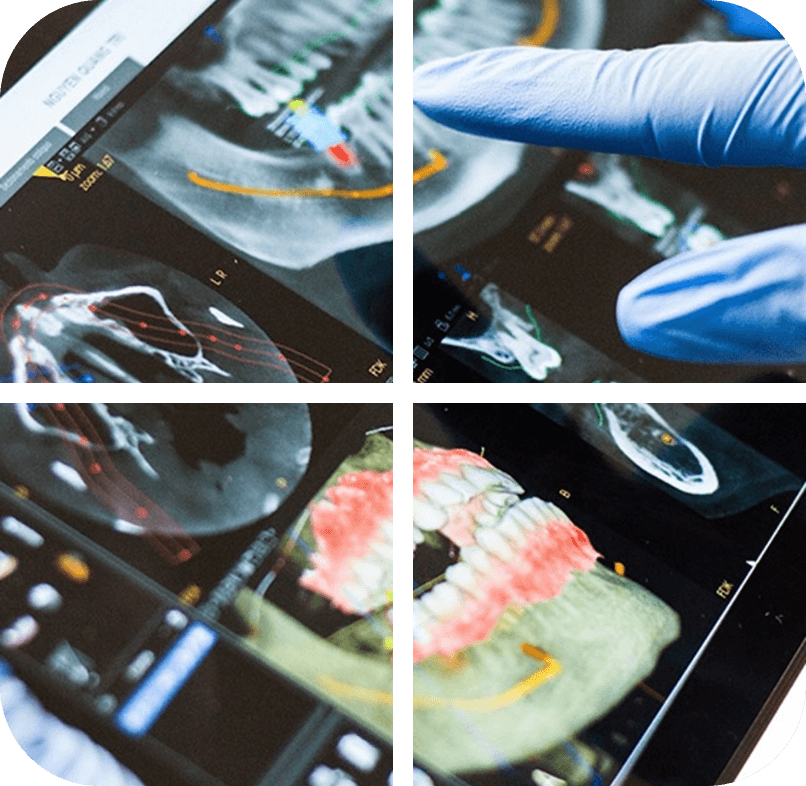 Dental technology