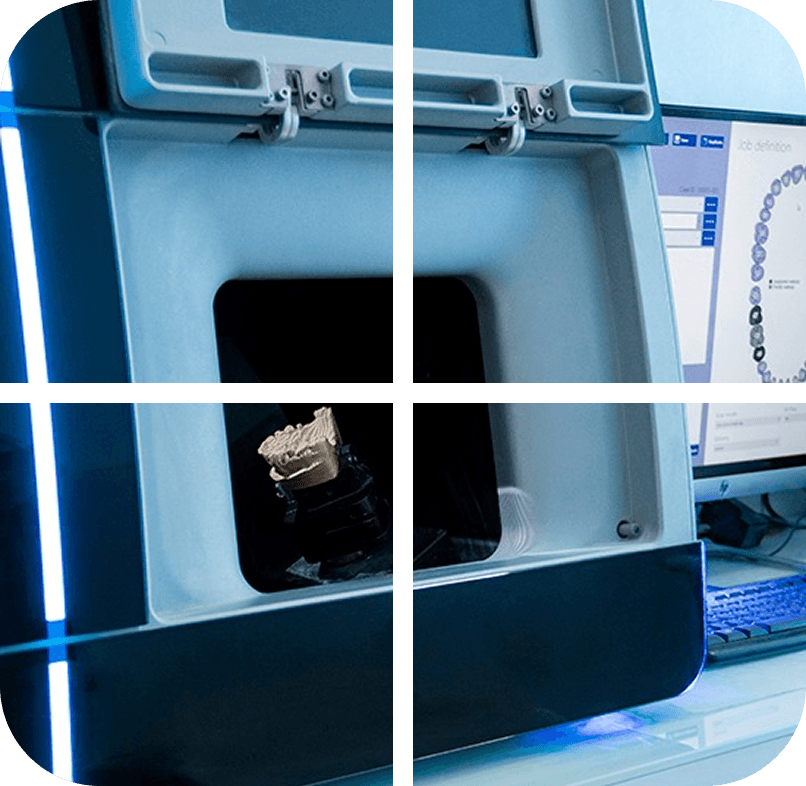 Digital dental printing