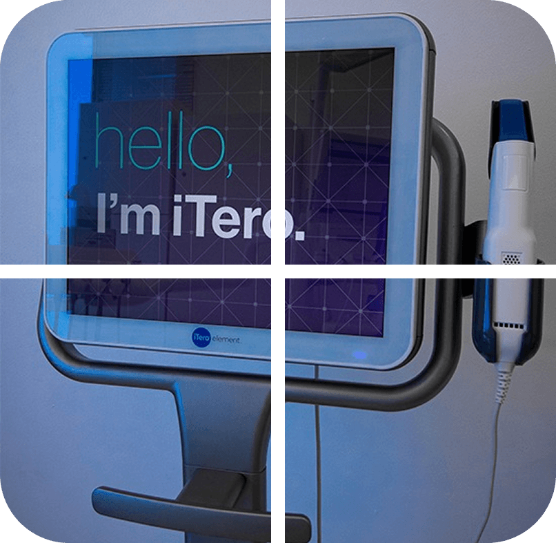 Digital scanner