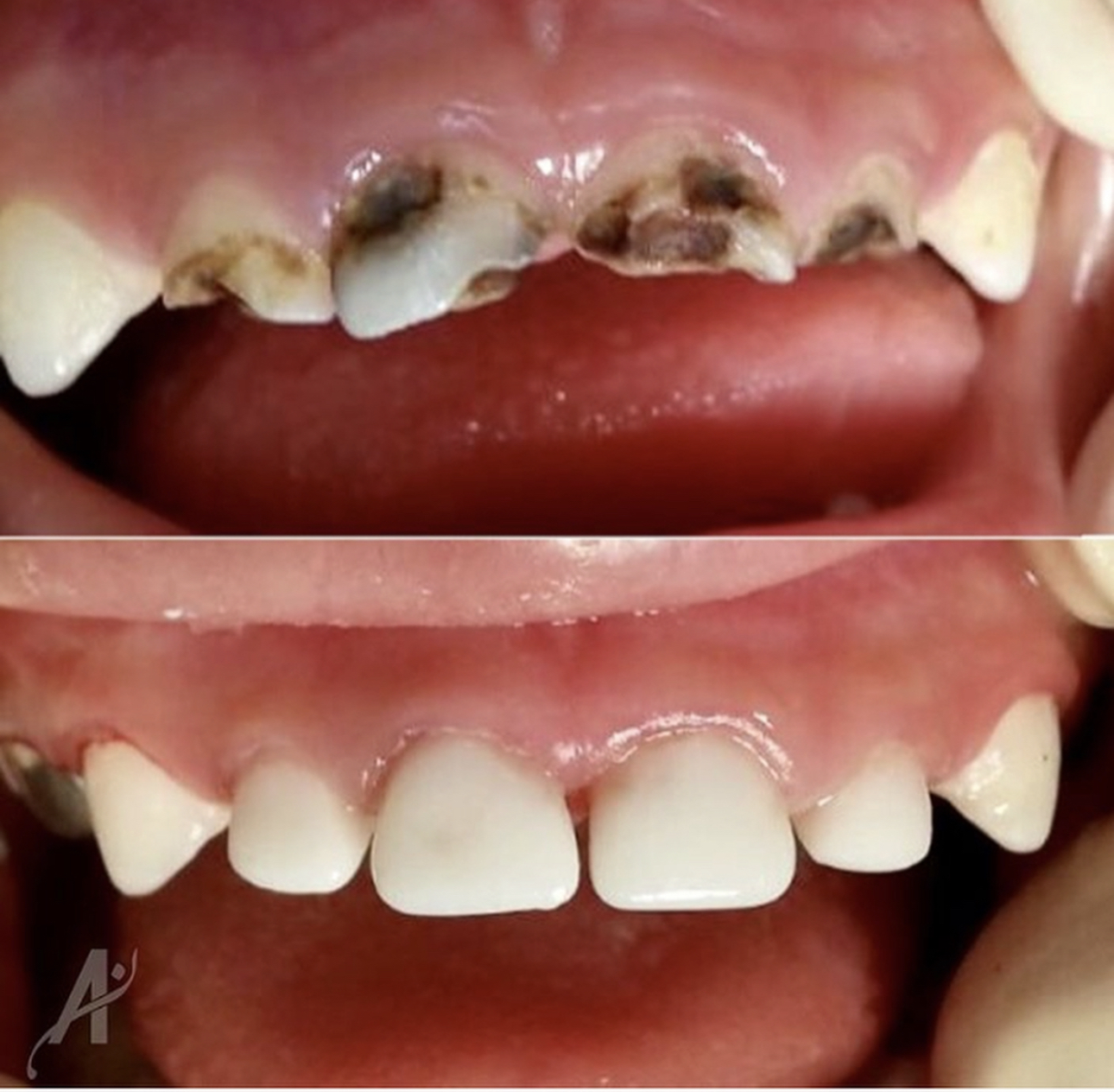  Therapeutic Cosmetic Fillings